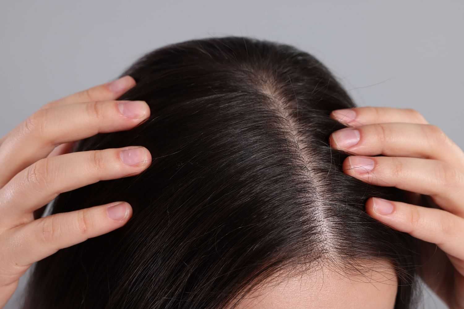 Hands parting dark hair to reveal scalp.